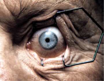 Smoking causes blindness