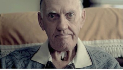 Smoking causes throat cancer