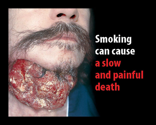 Warning picture